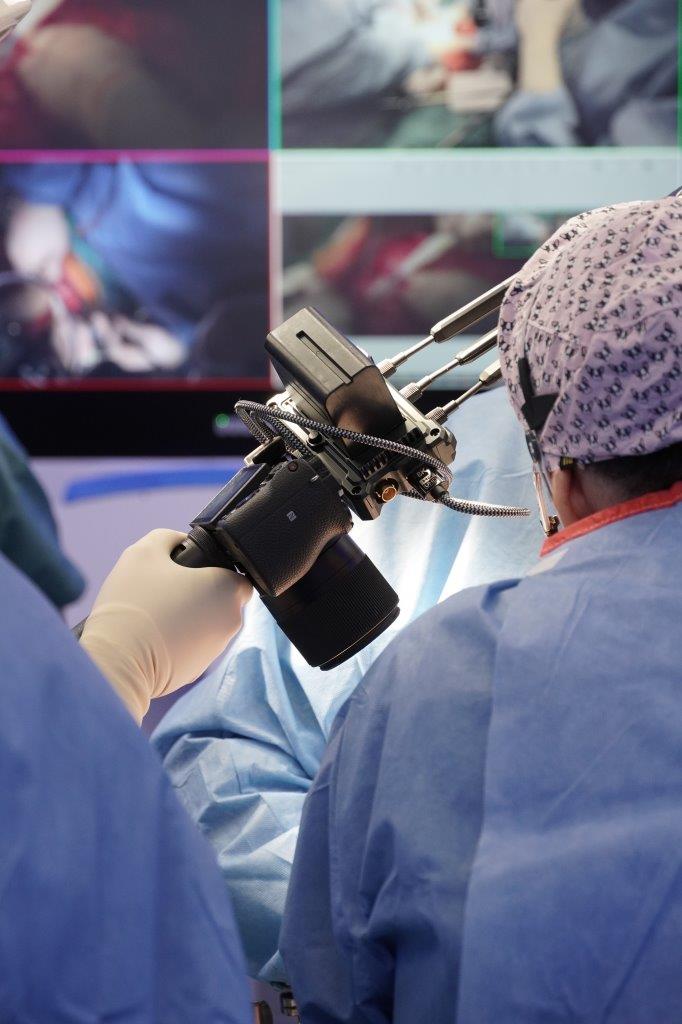 Operacion de peitoneo